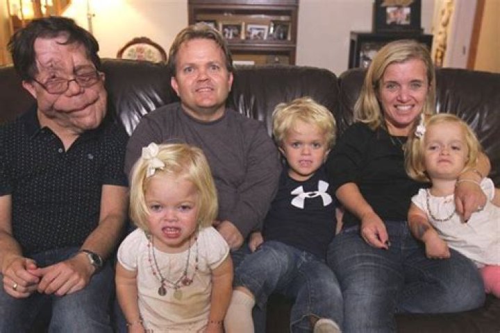 Adam Pearson Age: Unveiling the Journey and Legacy of a Remarkable Figure