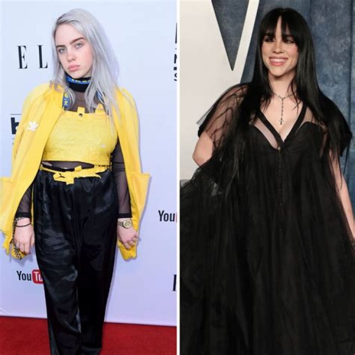 Billie Eilish Breast Reduction: The Truth Behind the Headlines