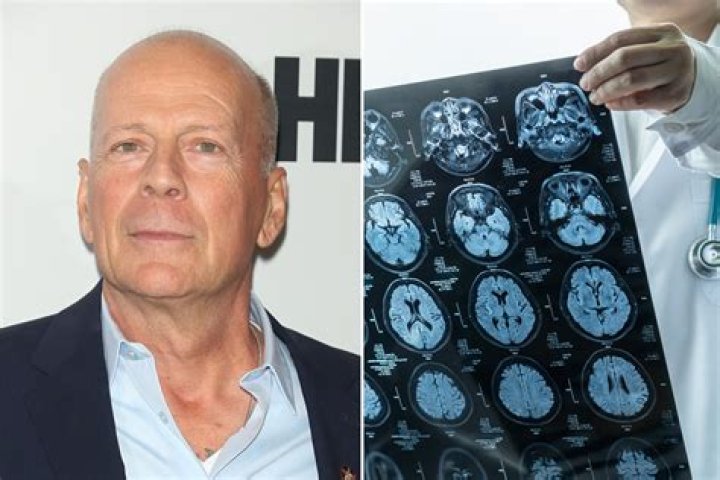 Bruce Willis: The Truth About His Health and Rumors of Death