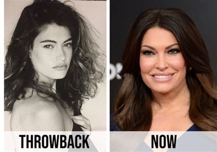 Kimberly Guilfoyle Before and After: A Detailed Transformation Journey