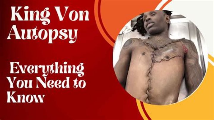 King Von Autopsy Picture: A Detailed Examination