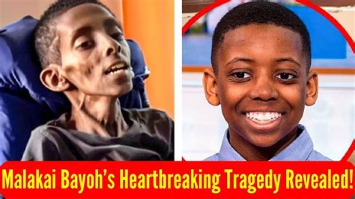 Malakai Bayoh Illness: A Comprehensive Look at the Health Challenges Faced by This Young Star