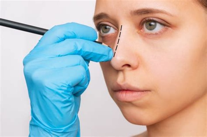 Mercedeschlapp Facesurgery: A Comprehensive Guide to the Procedure, Benefits, and Risks