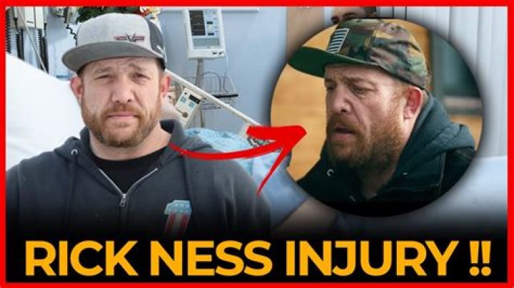 Rick Ness Nose: A Comprehensive Exploration of the Phenomenon
