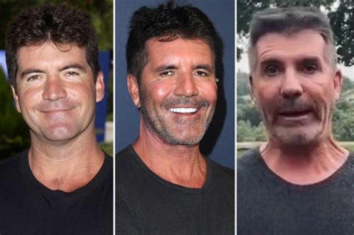 Simon Cowell's Illness: A Comprehensive Look at His Health Journey
