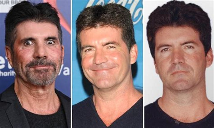 Simon Cowell and Disability: A Comprehensive Exploration