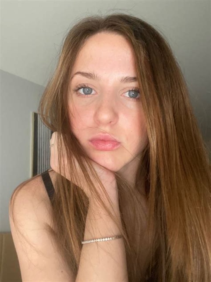 Unveiling Scars Wonderland OnlyFans: A Comprehensive Guide